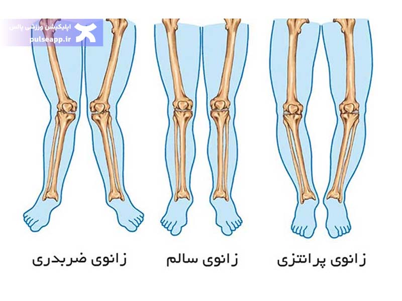 نیازمندی به حرکات اصلاحی