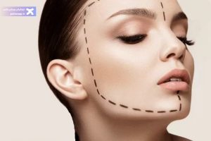 تصویر زاویه سازی صورت با ورزش + برنامه تمرینی